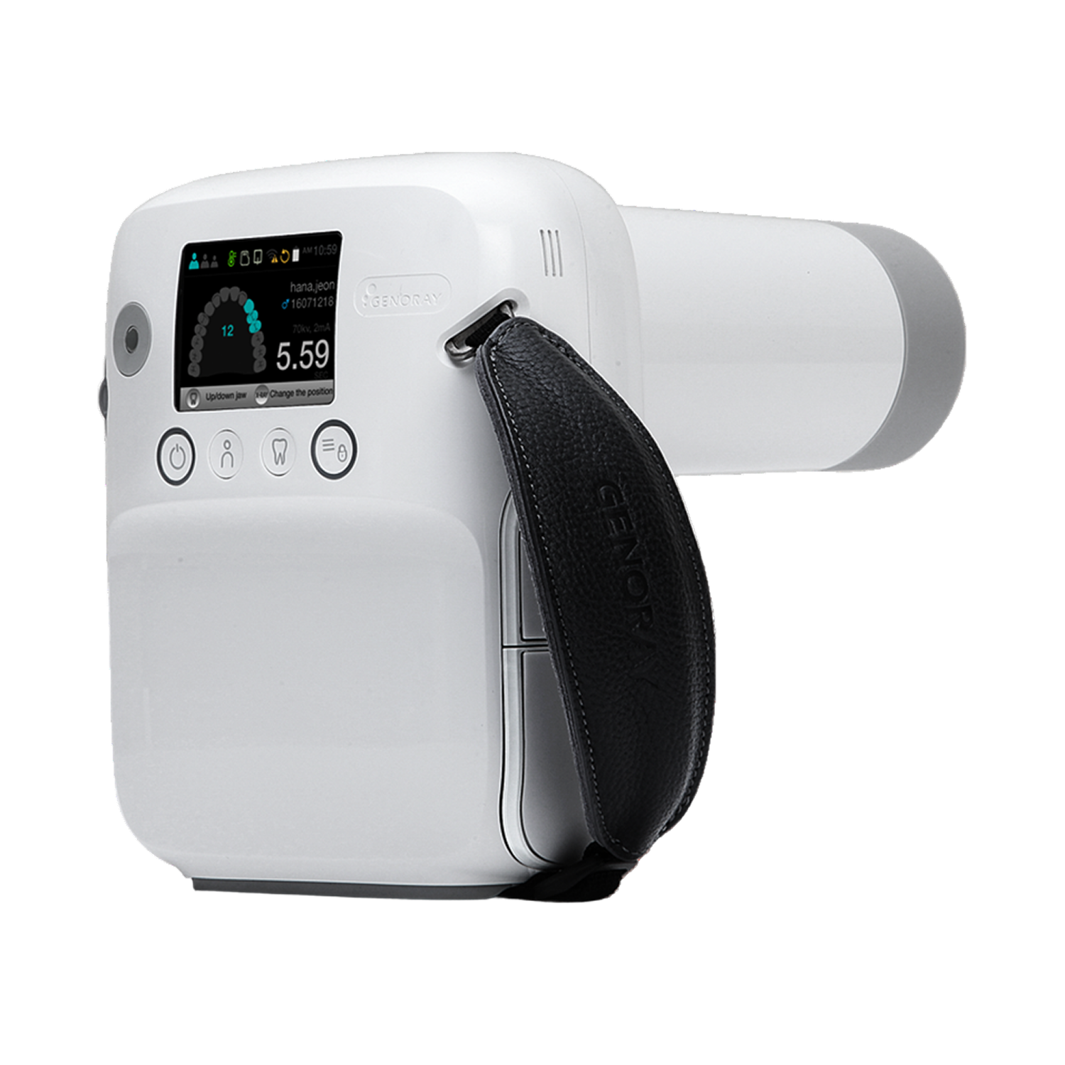 All-In-One Portable X-ray System Port X-IV