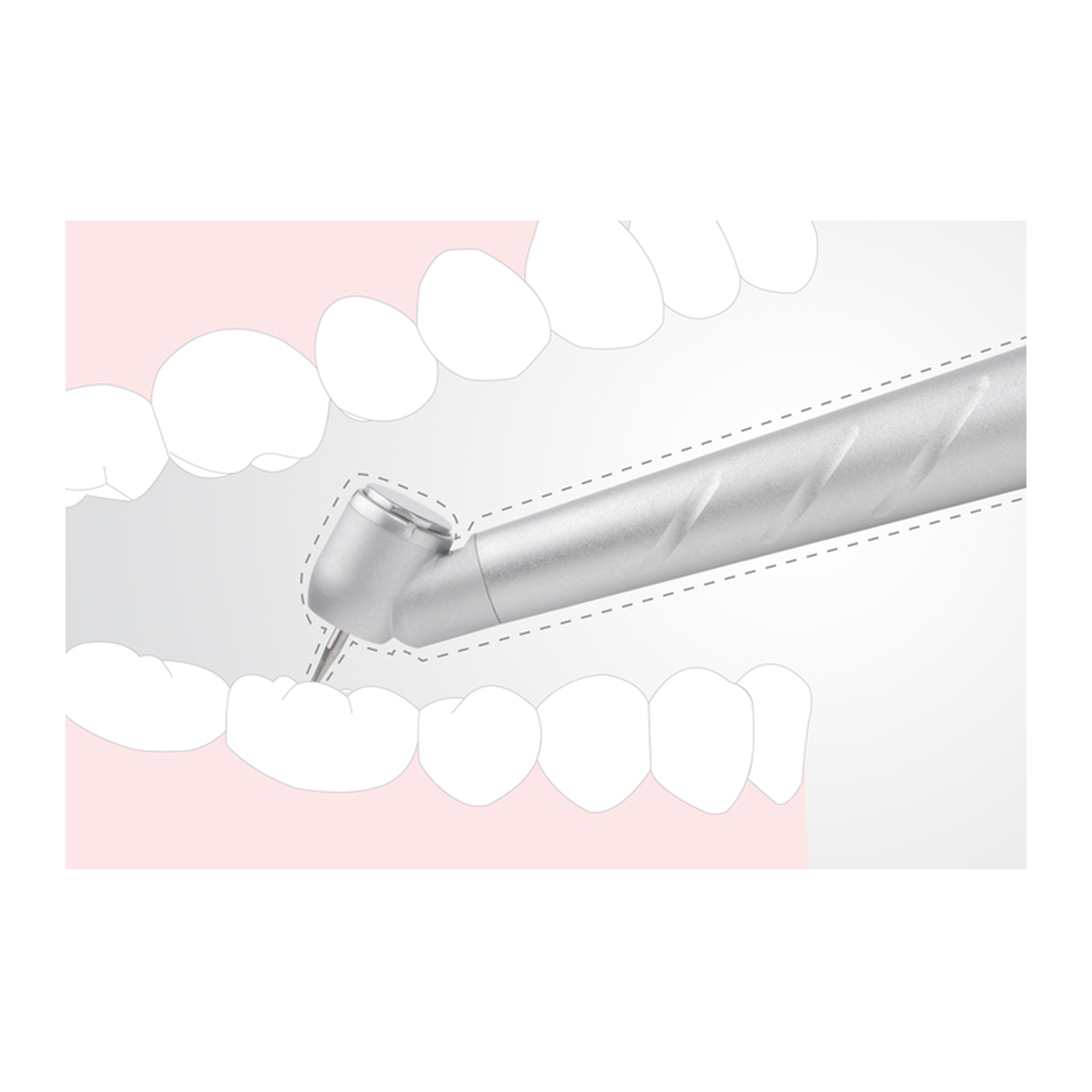Beyes High speed air M200 Surgical 45