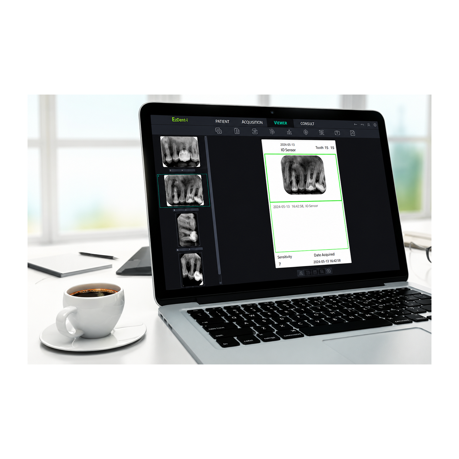 Duray Intraoral sensors