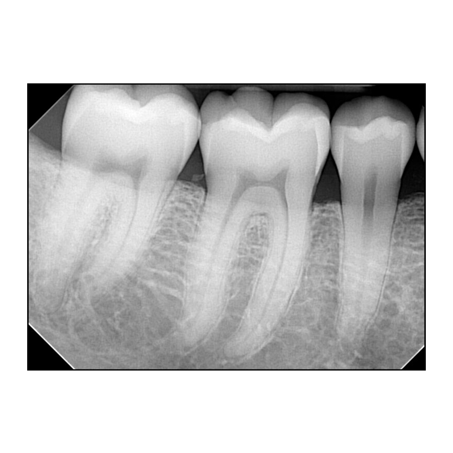 Eva Digital Intraoral Sensors