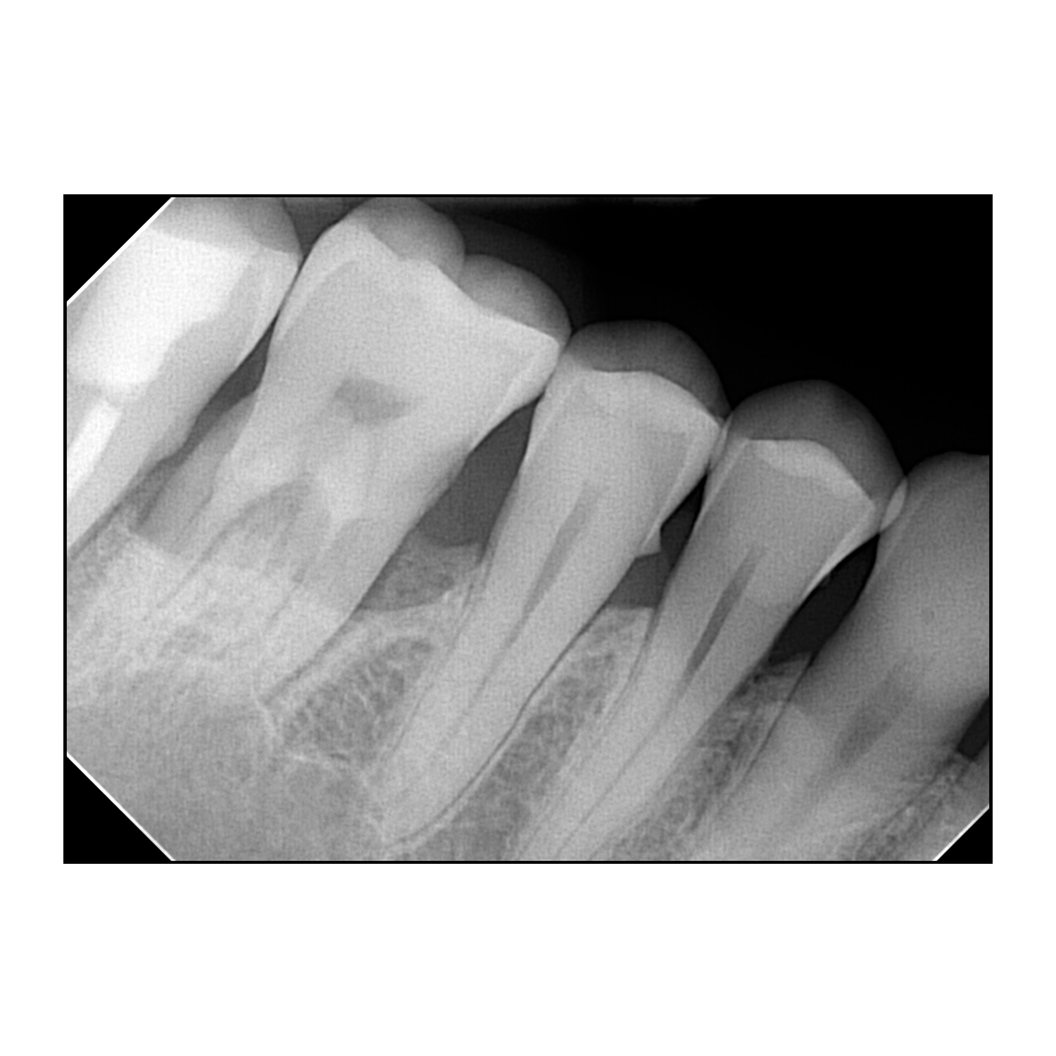 Eva Digital Intraoral Sensors