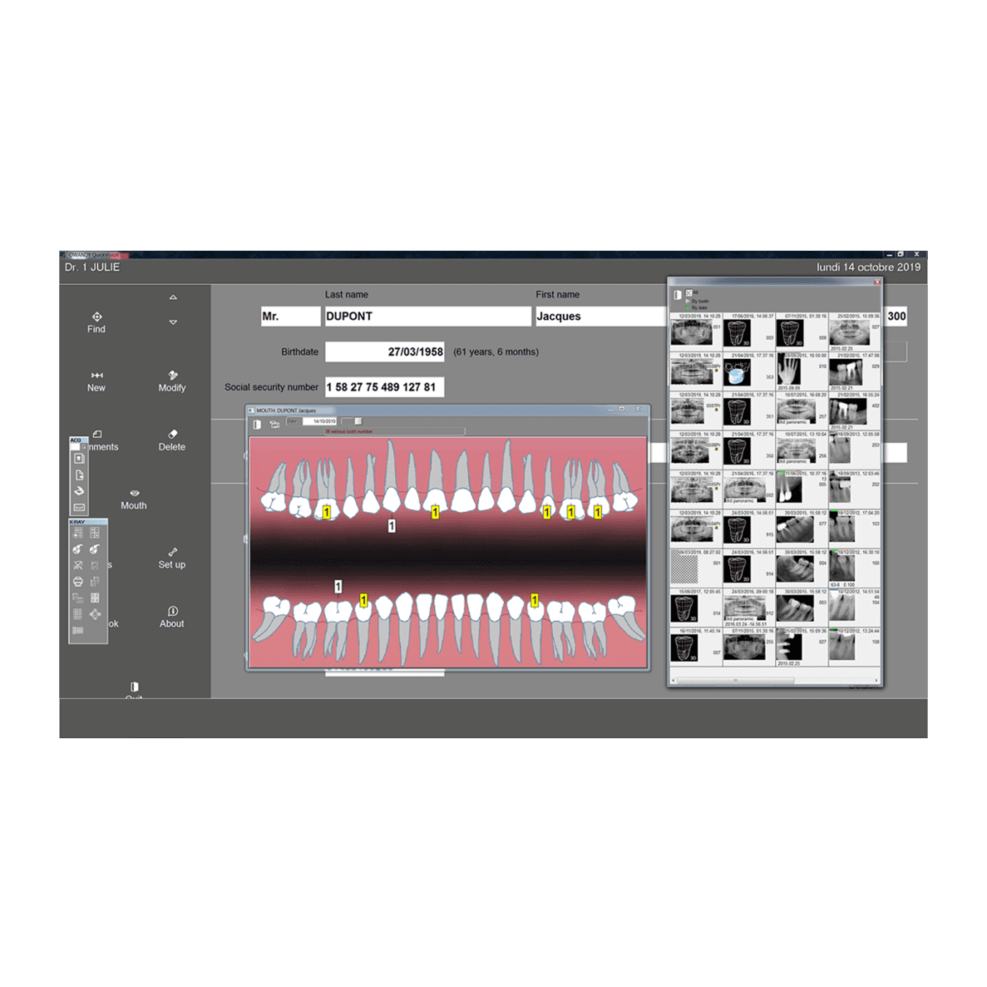 Owandy-CR² PSP Scanners