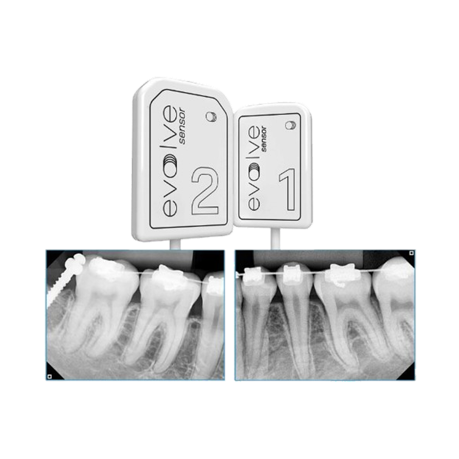 Evolve X-Ray: Portable Dental X-Ray
