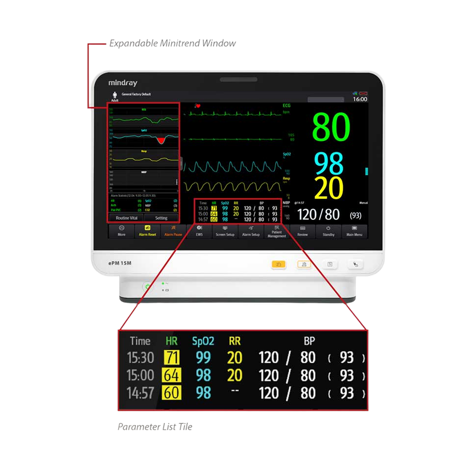 ePM 10M, 12M and 15M Patient Monitors