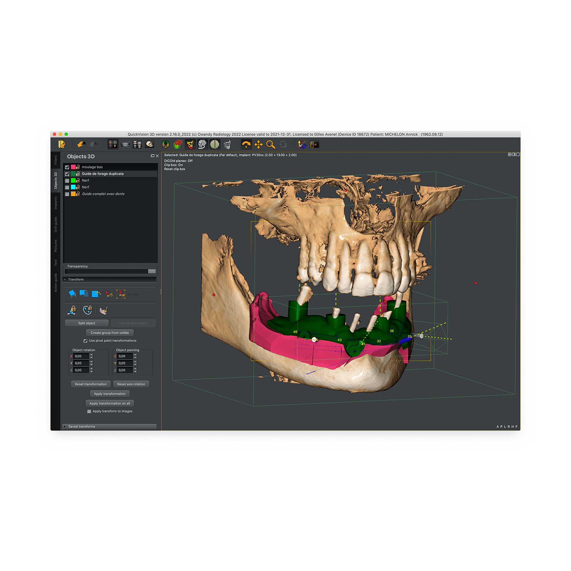 Quickvision 3D