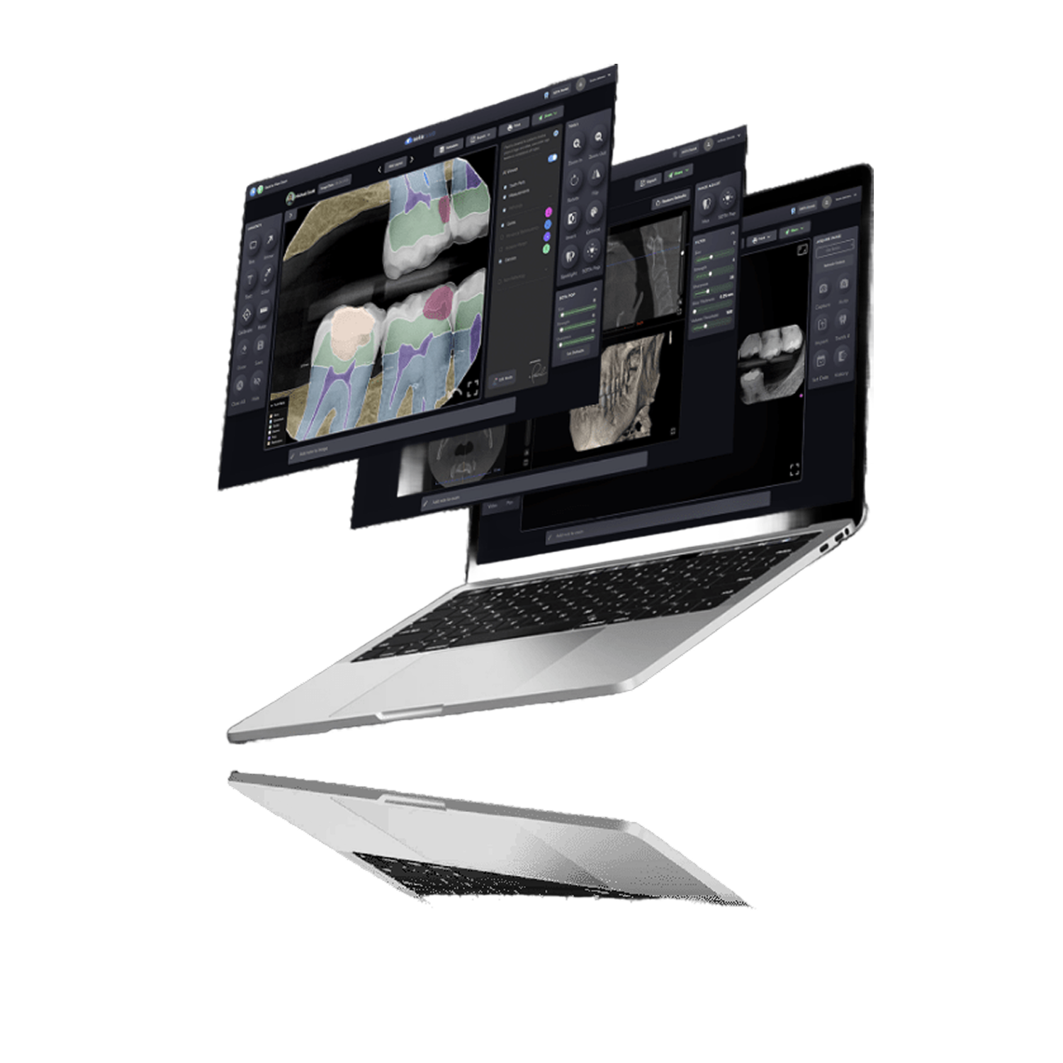 SOTA Cloude Software