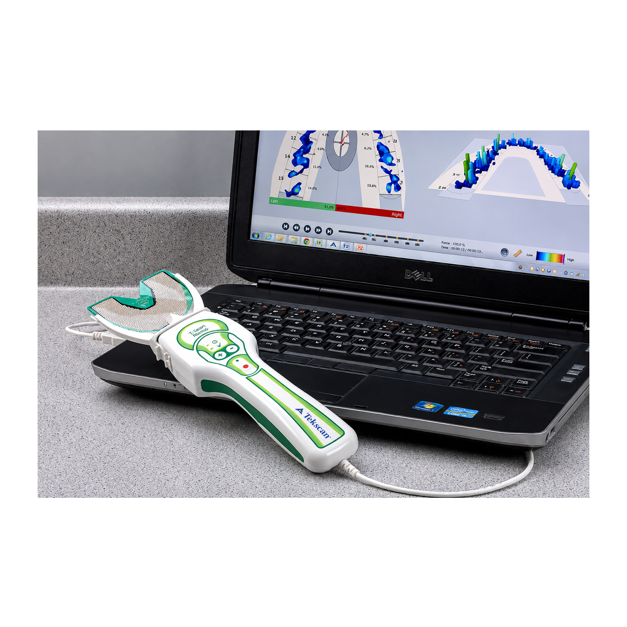 T-Scan Novus