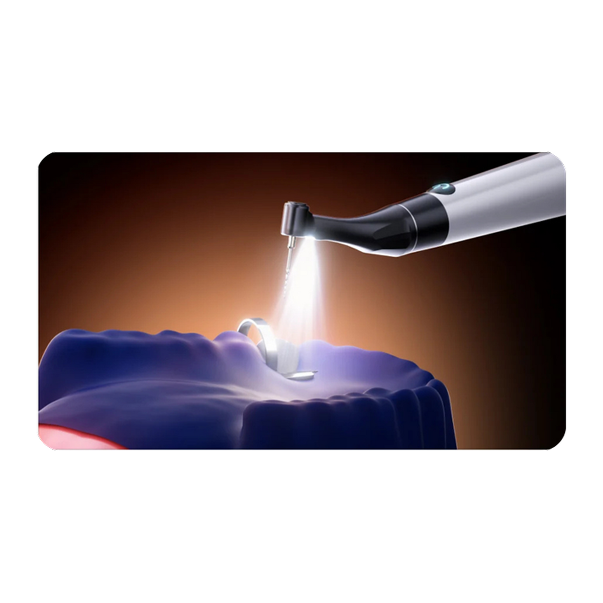 Woodpecker® Endo GT Pro Endo Motor with Built-In Apex Locator, LED Contra-Angle, Up to 3000 RPM