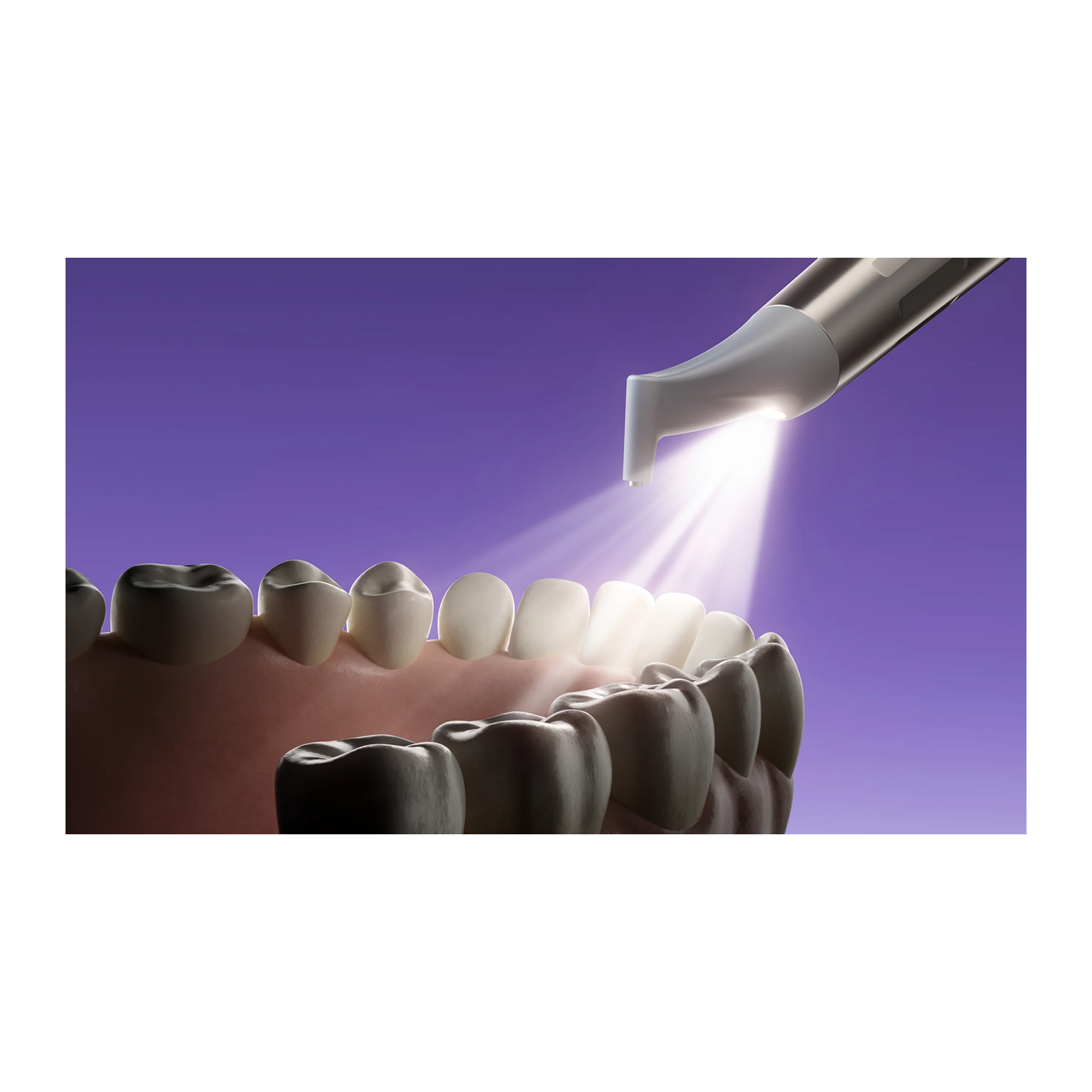 Woodpecker® PT-E Air Polisher & Ultrasonic Scaler