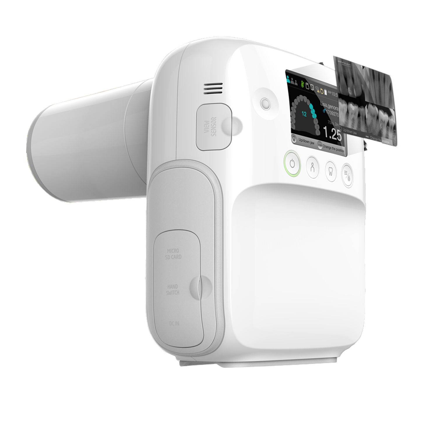 All-In-One Portable X-ray System Port X-IV