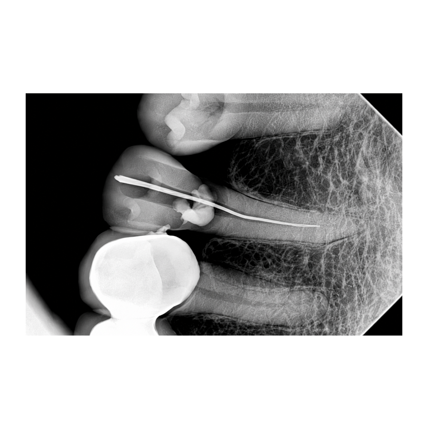 Duray Intraoral sensors