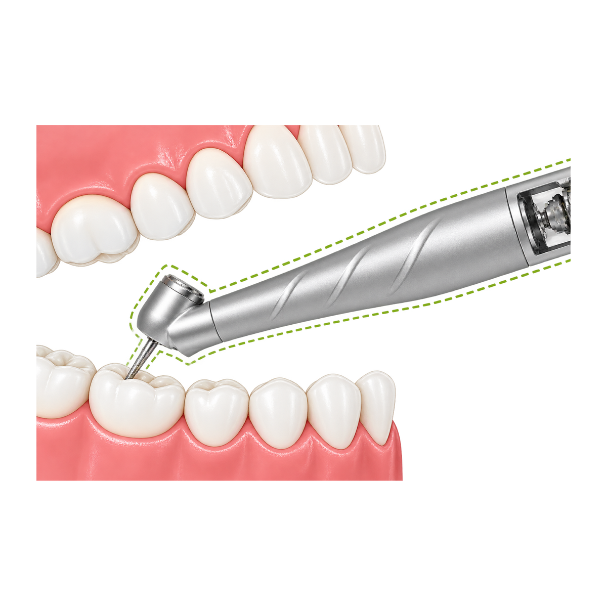AirLight M800 Surgical 45
