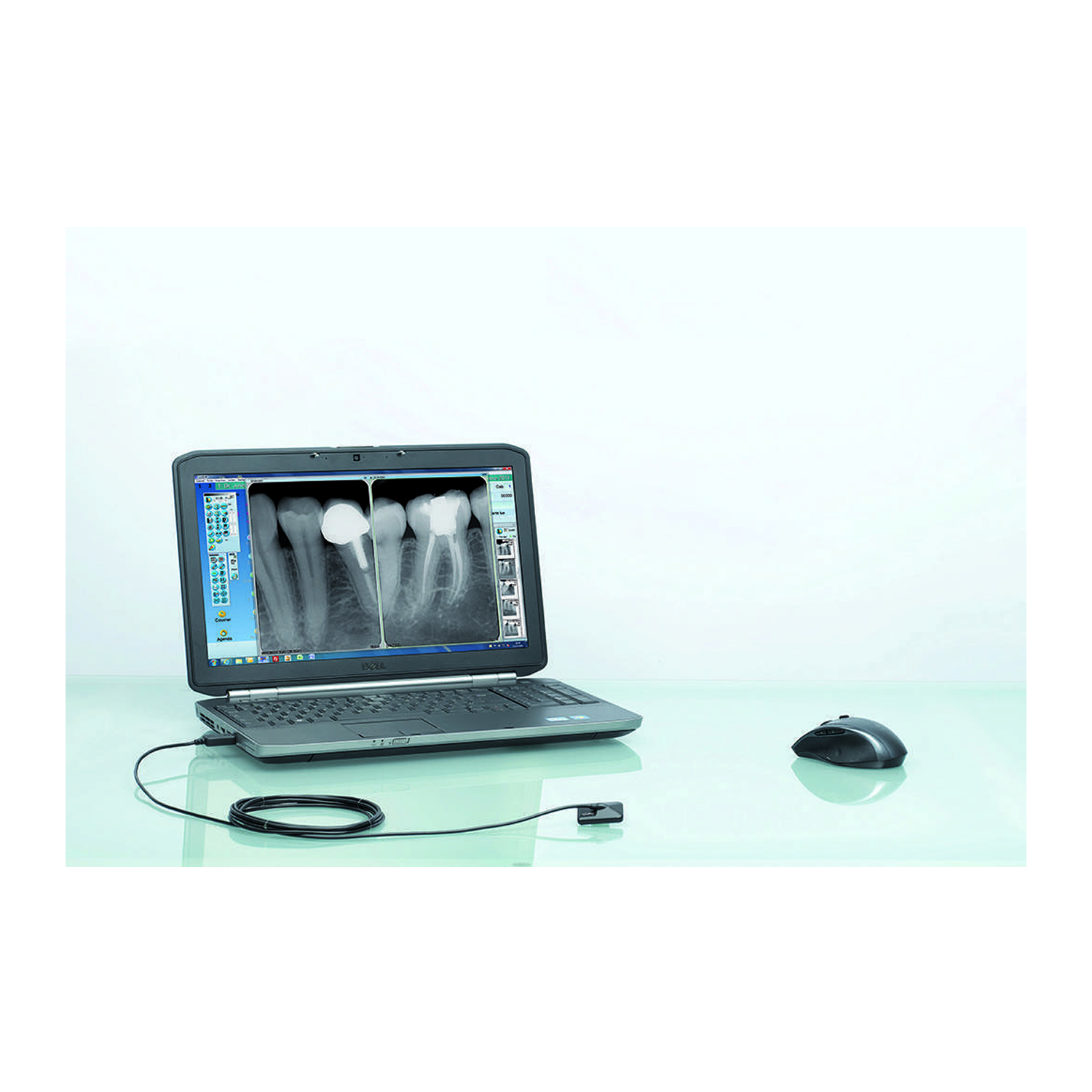 ONE Dental Intraoral Sensor