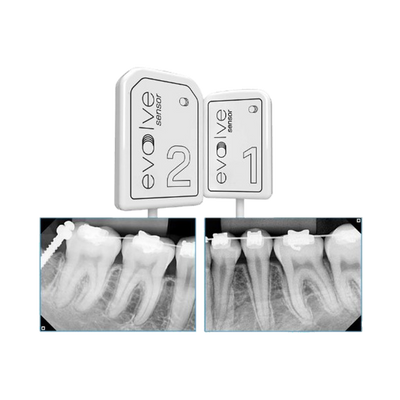 Evolve X-Ray: Portable Dental X-Ray