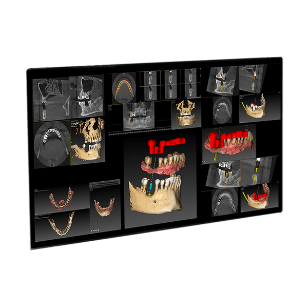 Quickvision 3D