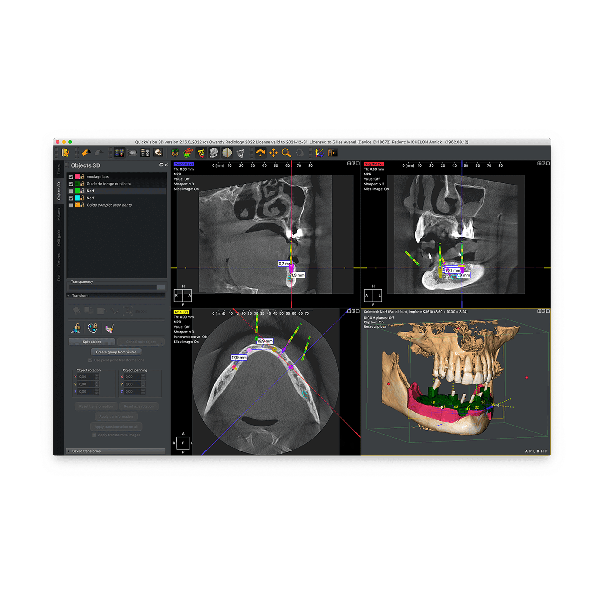 Quickvision 3D