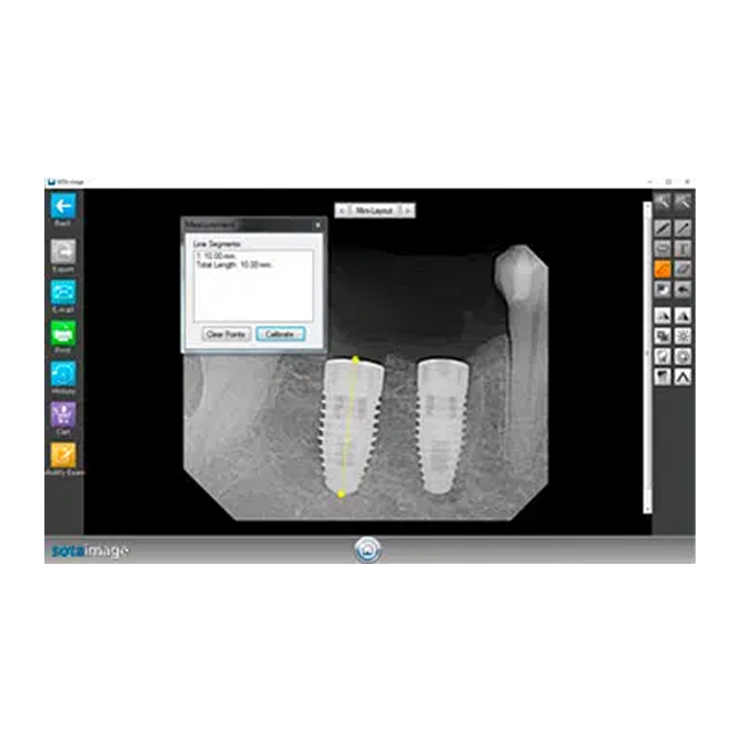 SOTA Image Software