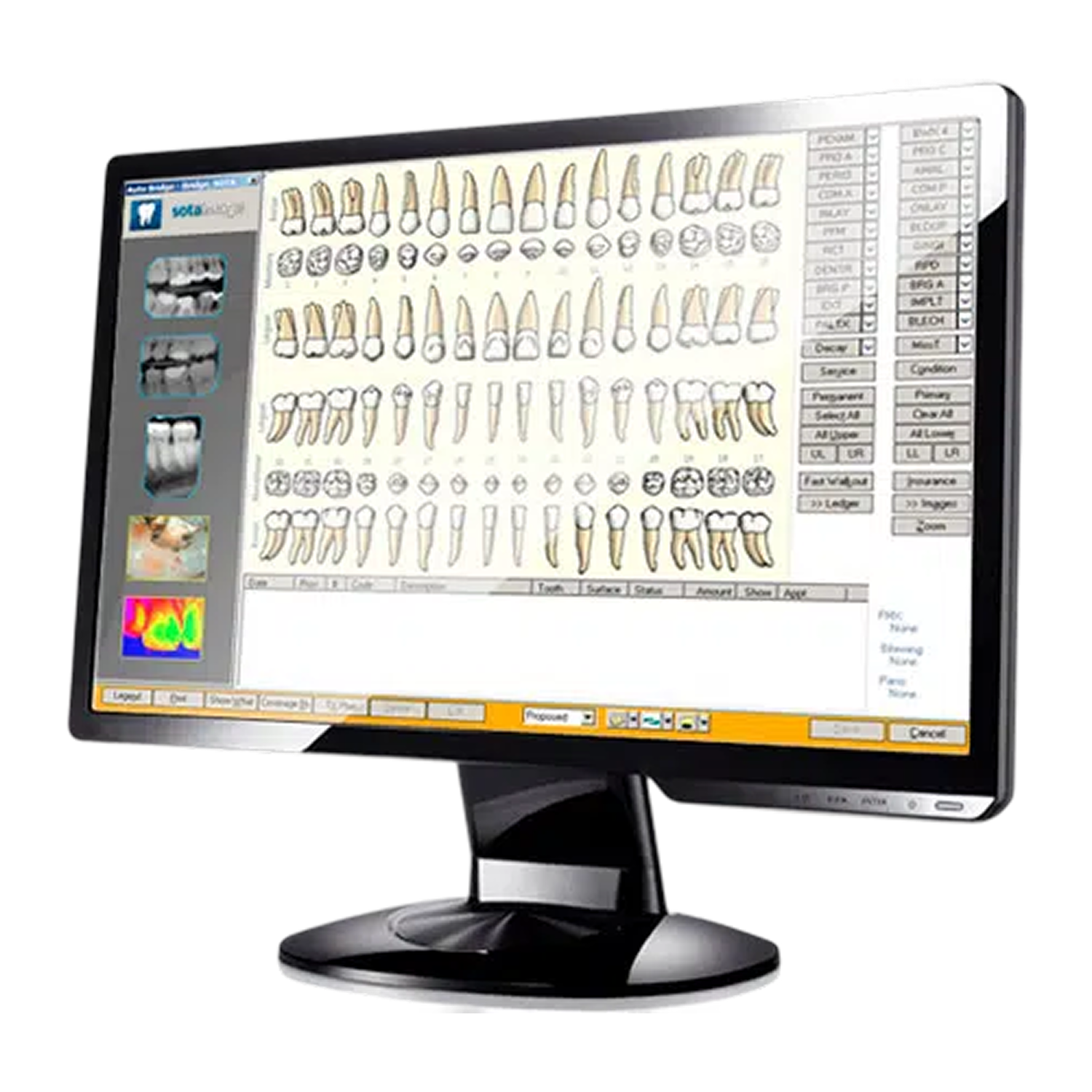 SOTA Image Software