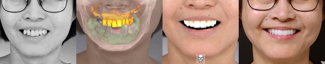planmeca CBCT - dental cone beam computed tomography