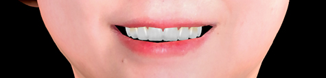 carestream CBCT - online dental supply companies