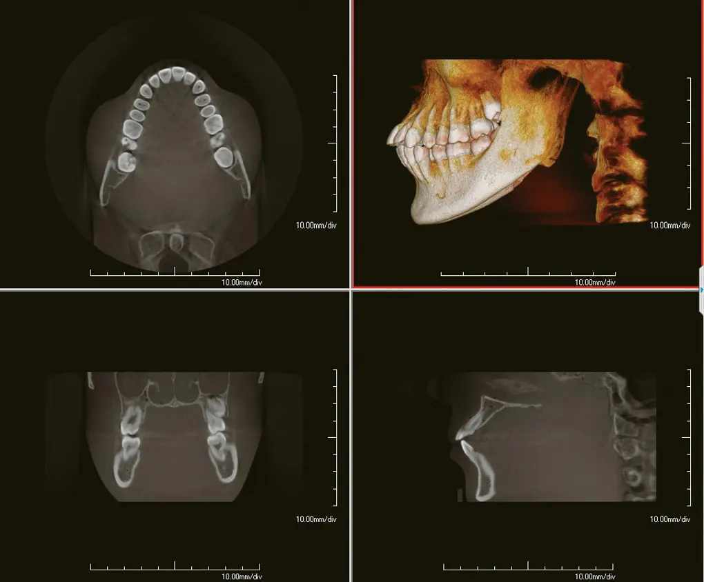 web design services chicago - dental cone beam scan
