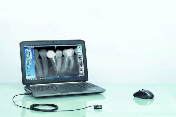 ONE Dental Intraoral Sensor <h3 style="color:#ff8516; font-size:22px !important; line-height: 24px !important;">Owandy </h3> - Image 6