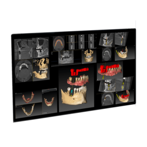 Quickvision 3D <h3 style="color:#ff8516; font-size:22px !important; line-height: 24px !important;"> </h3>